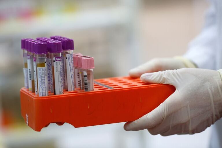 IPS informa sobre el laboratorio y toma de muestras en Villeta.