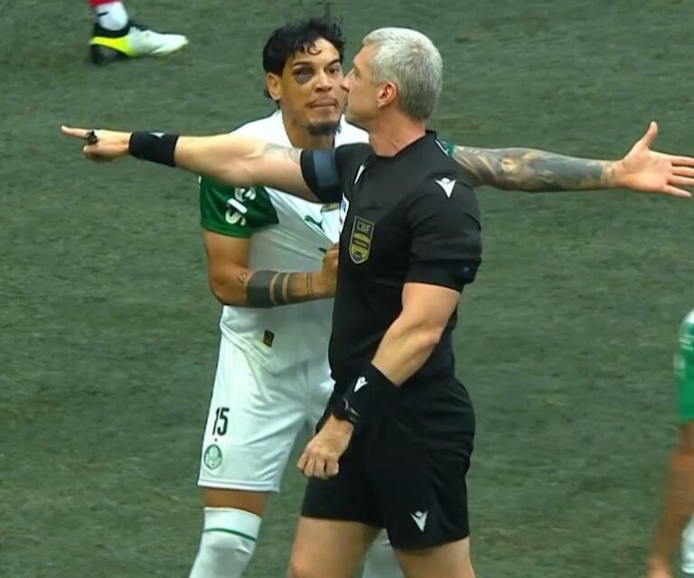 Gustavo Gómez entra al campo con un ojo notablemente lastimado – Fútbol Internacional