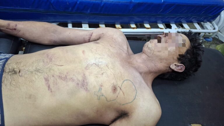 Pedro Juan Caballero: Un supuesto intento de hurto domiciliario terminó con la muerte de un joven de 27 años