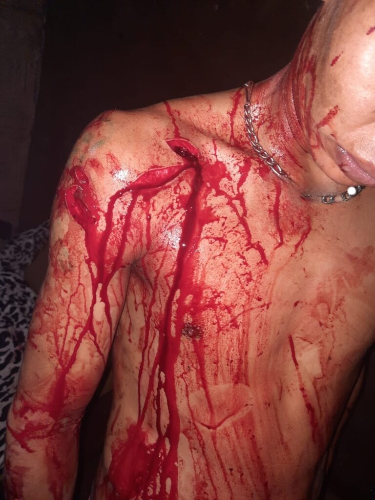Violencia familiar en Pedro Juan Caballero: Joven es apuñalado presuntamente por su padre