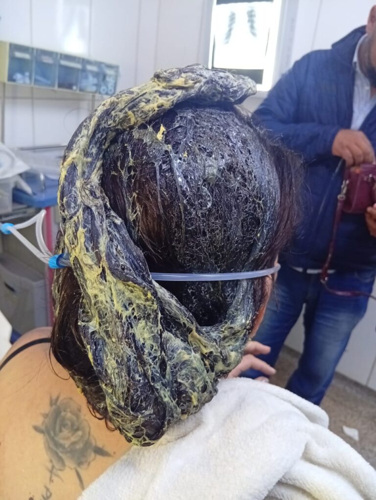 Violenta agresión en la Línea Internacional: Discutió con su pareja y le arrojó cola de zapatero
