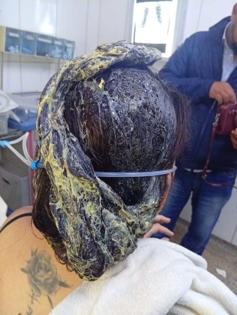 Peluquero agredió a su pareja y escapó tras el ataque.