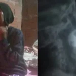 Urgente intervención médica para mujer en Pedro Juan Caballero