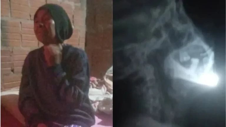 Urgente intervención médica para mujer en Pedro Juan Caballero